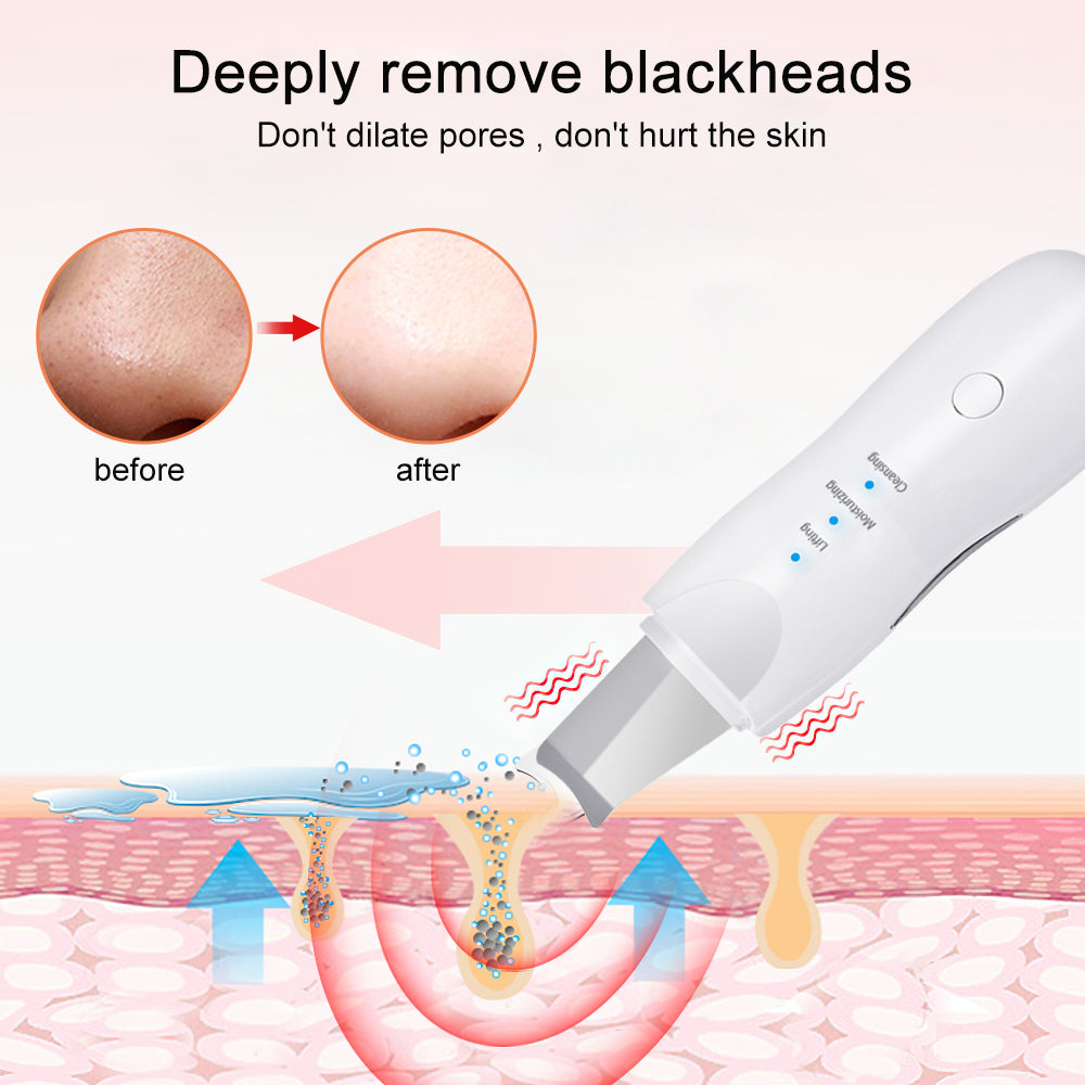 Ultrasonic Skin Scrubber Deep Face Cleaning Machine Peeling Shovel Facial Pore Cleaner Face Skin Scrubber Lift Beauty Instrument Ultrasonic Facial Scrubber Pore Blackhead Remover Spatula Deep Skin Spa